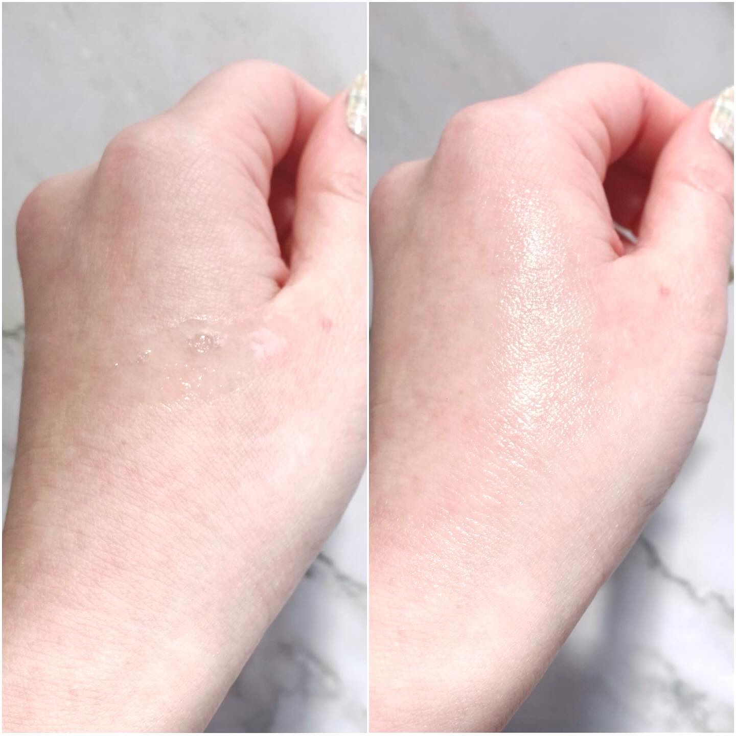 RXザ・アルファアルブチン2 ニキビ跡ケアセラム/COSRX/美容液を使ったクチコミ（3枚目）