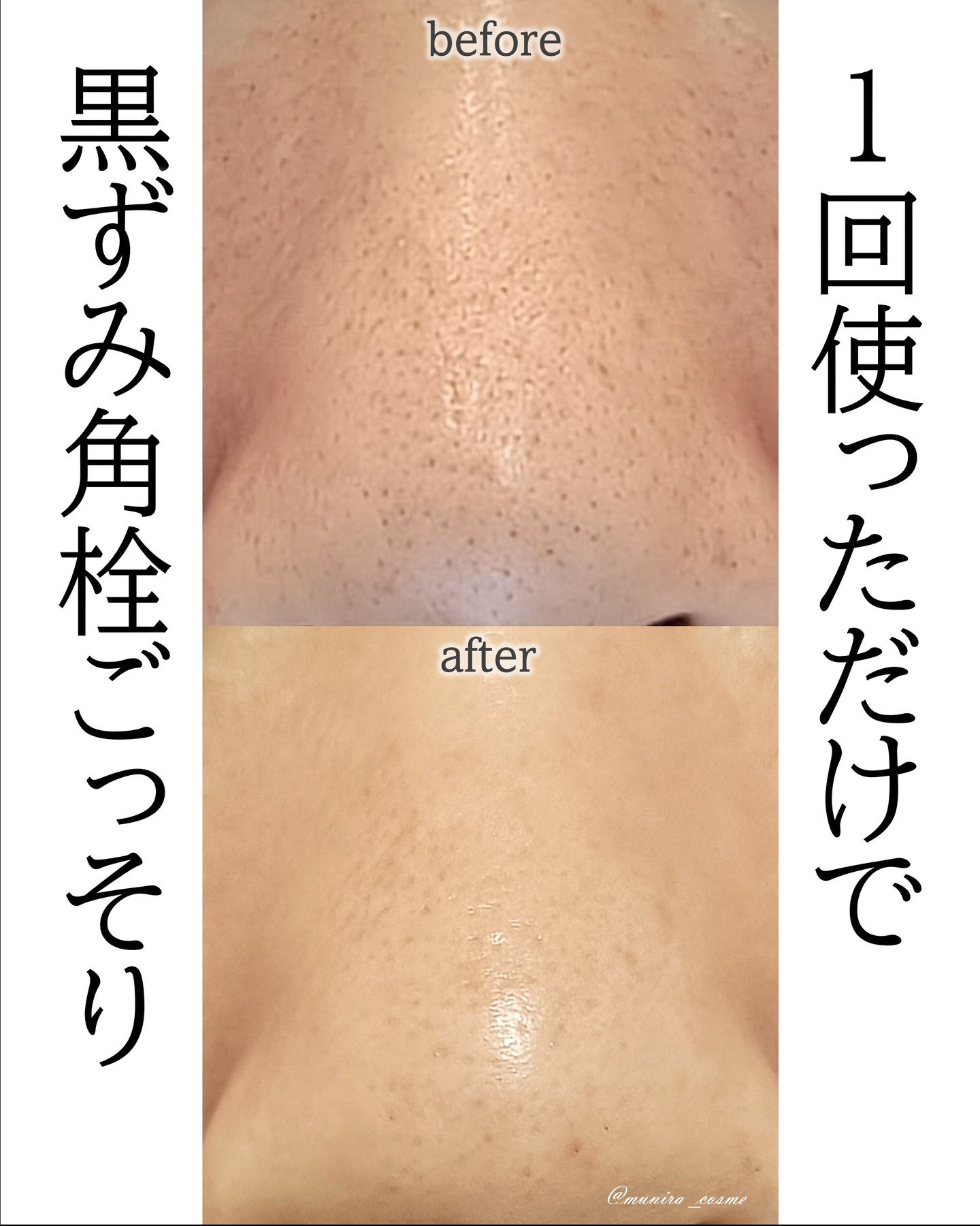 ナチュラルマイルドクリアノーズパック/ilso/シートマスク・パックを使ったクチコミ（1枚目）