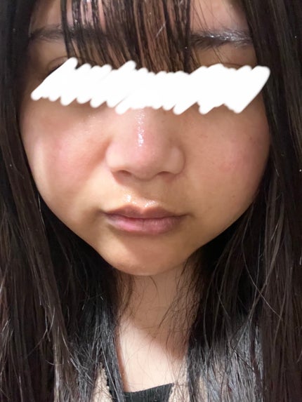 ゼロ毛穴パッド 2.0/MEDICUBE/トナーパッドを使ったクチコミ(10枚目)