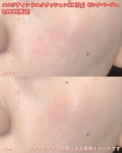 シルククッションRX/エルツティン/クッションファンデーションを使ったクチコミ(4枚目)