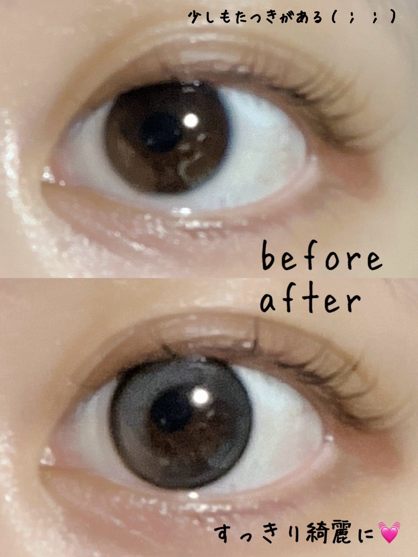 アイビューティー フィクサー WP/アストレア ヴィルゴ/二重まぶた用アイテムを使ったクチコミ(3枚目)
