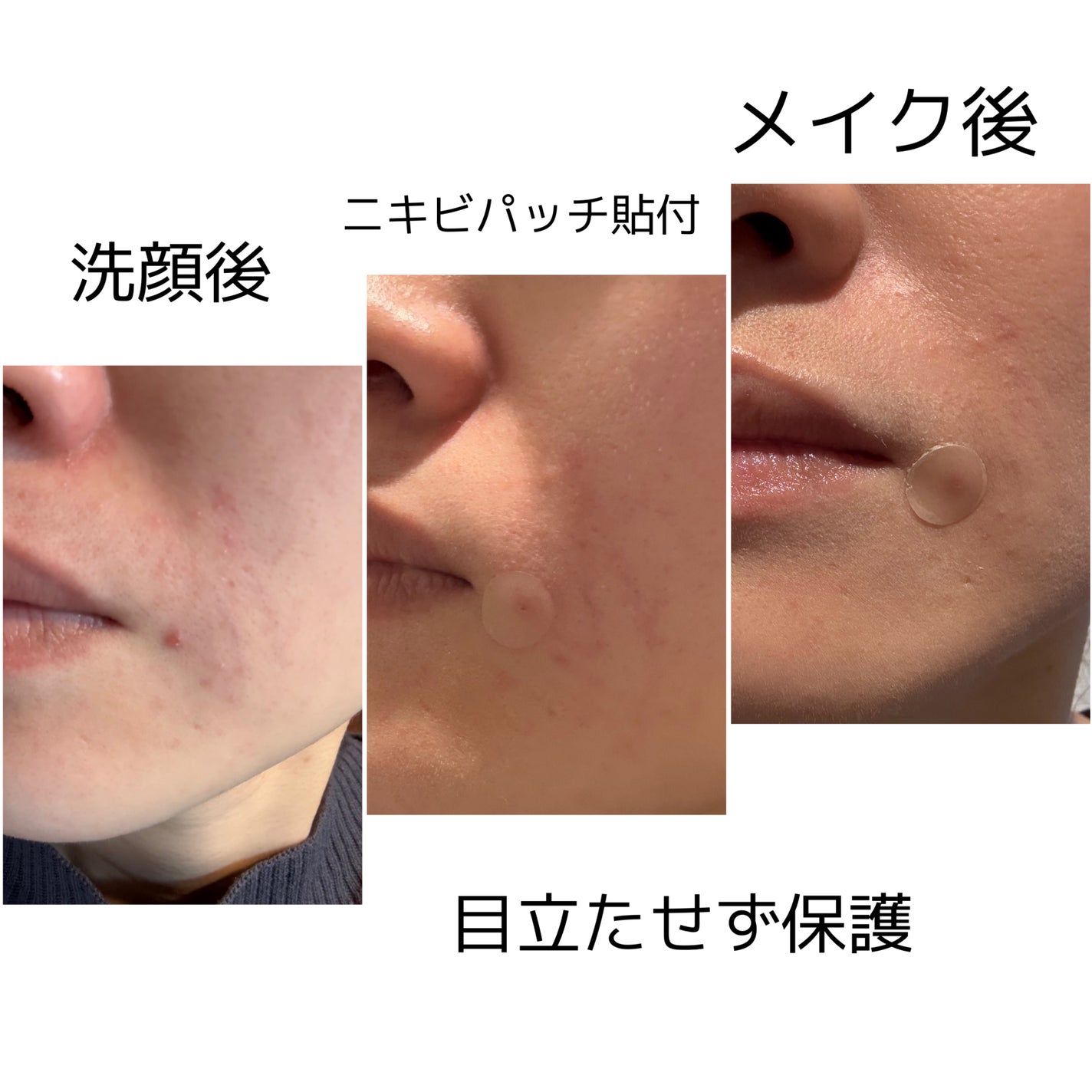 スポットイレイザー/NOLAHOUR/その他を使ったクチコミ(2枚目)