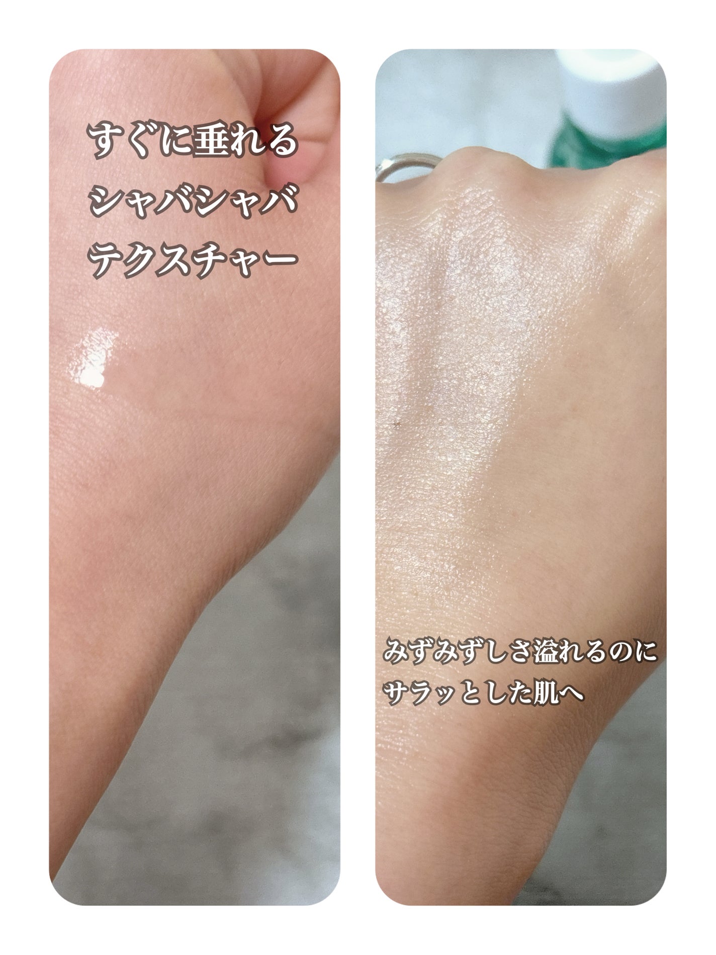 ダーマアンサーアゼライン酸ミントアンプル/CNP Laboratory/美容液を使ったクチコミ(4枚目)