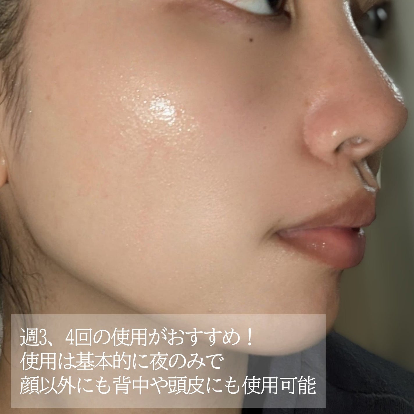 AZアゼライン酸10セラム/コスデバハ/美容液を使ったクチコミ(5枚目)