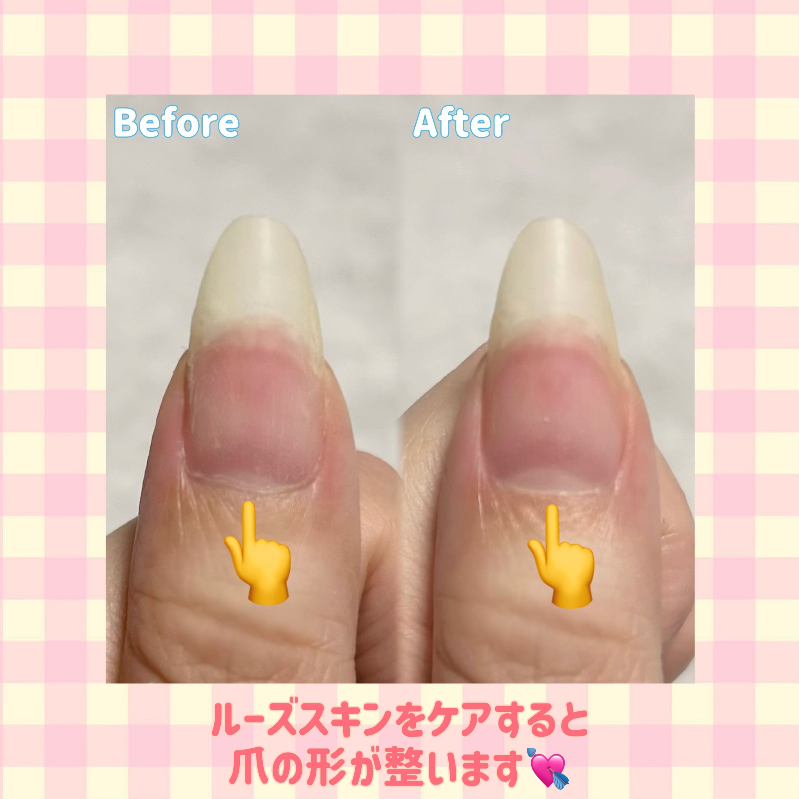 FINGER SUIT キューティクルオイルプッシャー/FINGER SUIT/ネイルオイル・トリートメントを使ったクチコミ（2枚目）