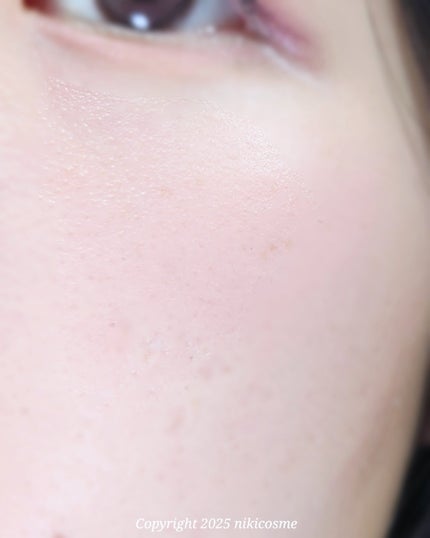 PDRNショット675/COSNORI/美容液を使ったクチコミ(6枚目)