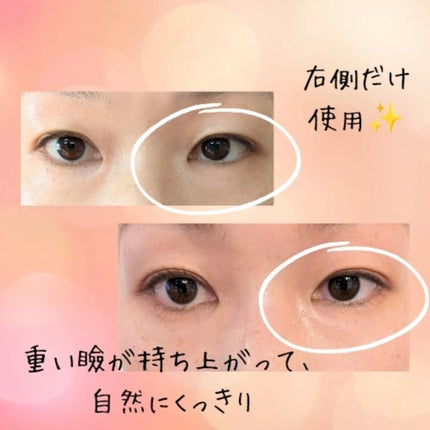 フリーファイバー120 スタンダードタイプ /メザイク/二重まぶた用アイテムを使ったクチコミ(2枚目)