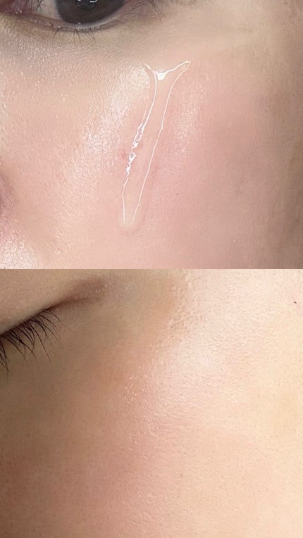 グルタチオンショットB3シミ跡セラム/It's skin/美容液を使ったクチコミ(5枚目)