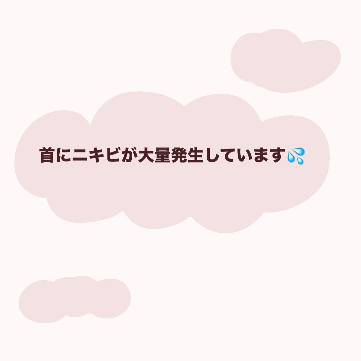 お芋ちゃん|10年以上ニキビに悩む保育士 on LIPS 「投稿するのを迷うくらい見られるのが嫌だったのですが、経過をまた..」(1枚目)