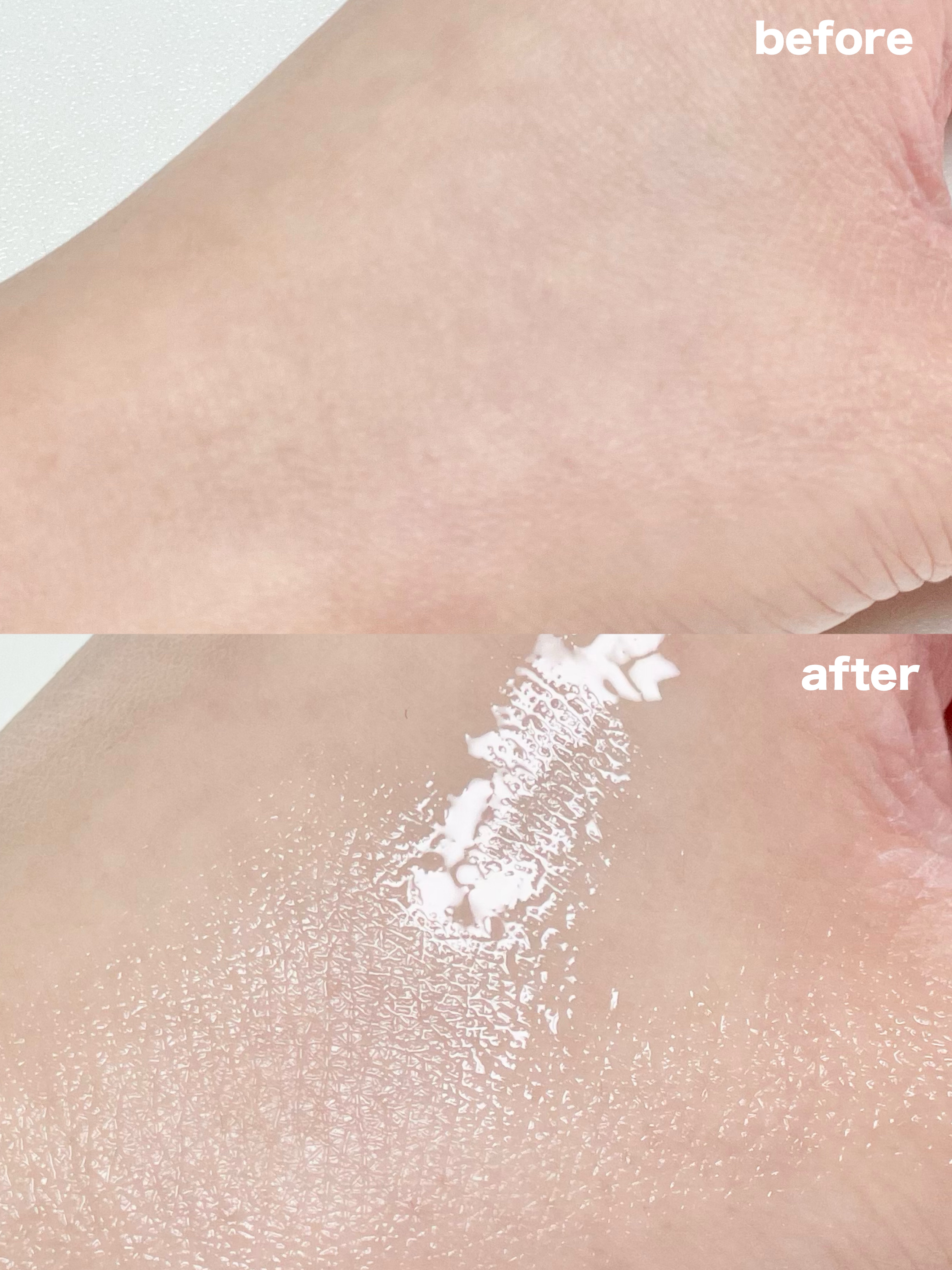 復活草ビフィダセラムファーミングドロップ/Abib /美容液を使ったクチコミ（3枚目）