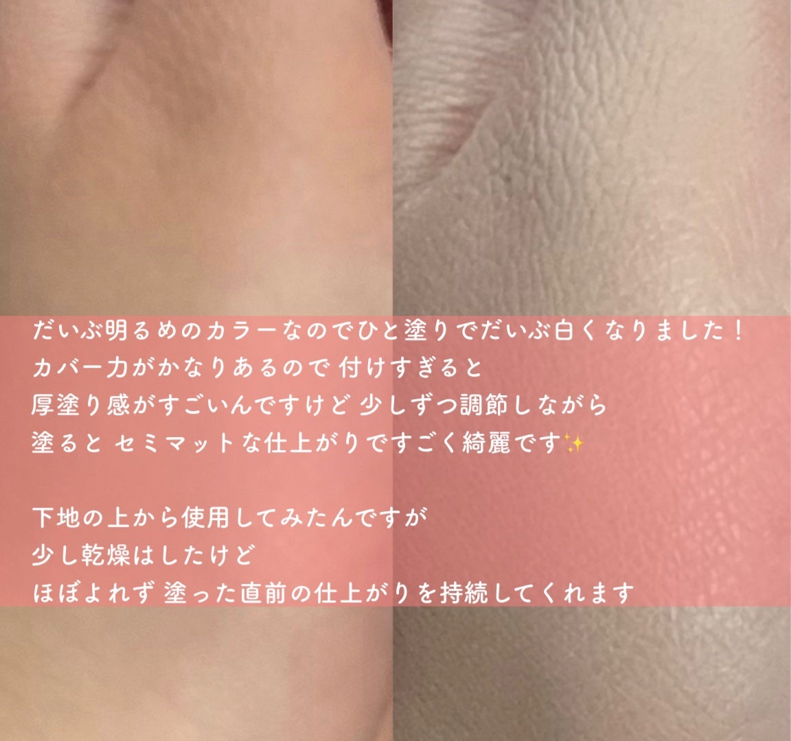 ããŒãã«ãããã«ããŒã¯ãã·ã§ã³/espoir/ã¯ãã·ã§ã³ãã¡ã³ããŒã·ã§ã³ã䜿ã£ãã¯ãã³ãïŒ4æç®ïŒ