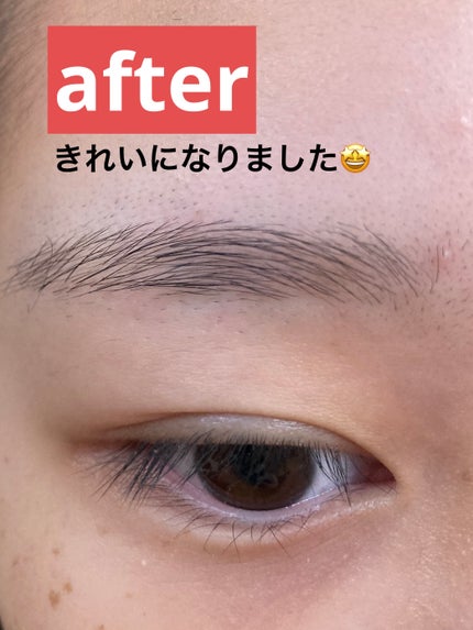 携帯用かみそり/無印良品/ムダ毛ケアを使ったクチコミ(5枚目)