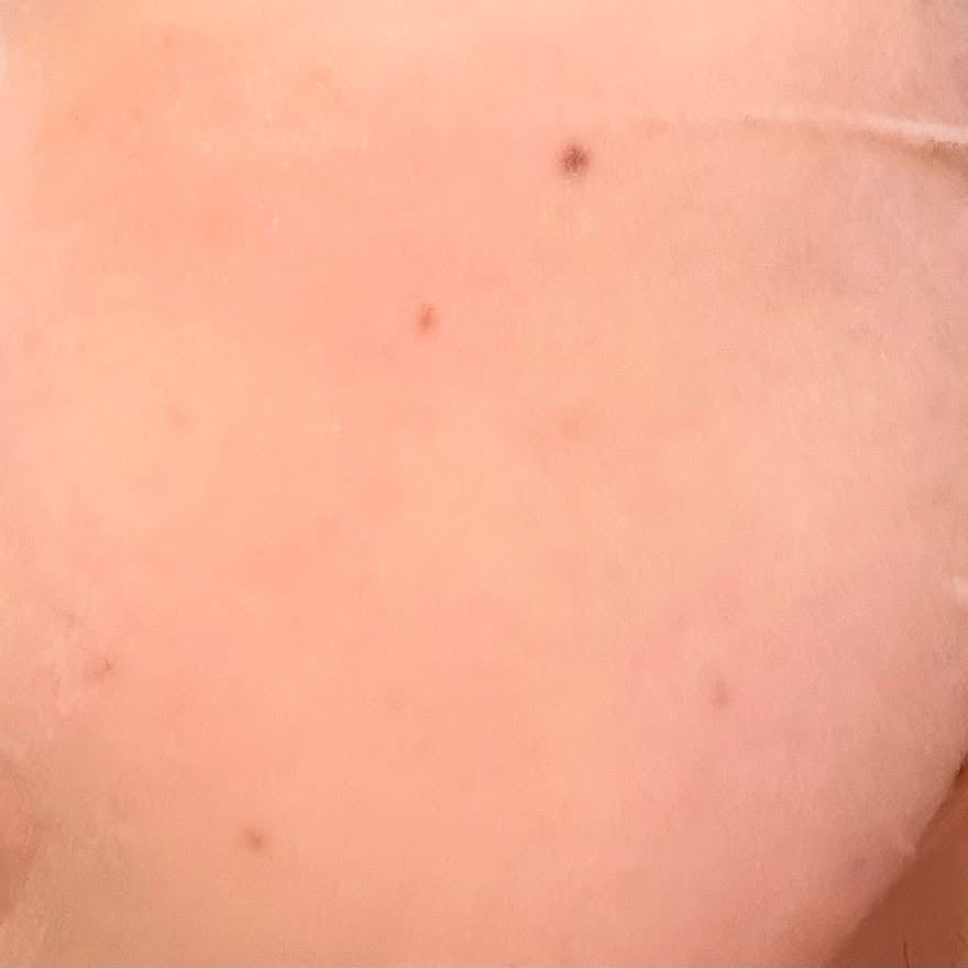 PDRNデイリーマスクパック/COSNORI/その他スキンケアを使ったクチコミ(5枚目)