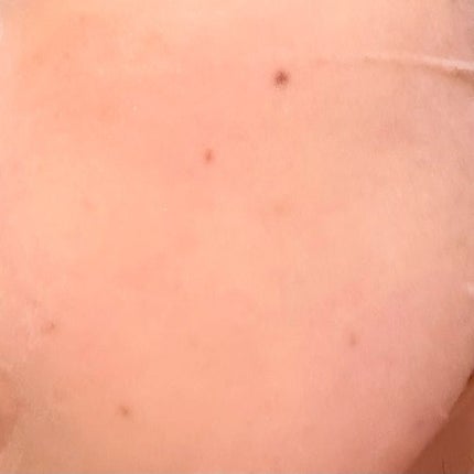 PDRNデイリーマスクパック/COSNORI/その他スキンケアを使ったクチコミ(5枚目)