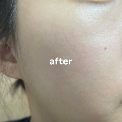 グルタチオンショットB3シミ跡セラム/It's skin/美容液を使ったクチコミ(7枚目)