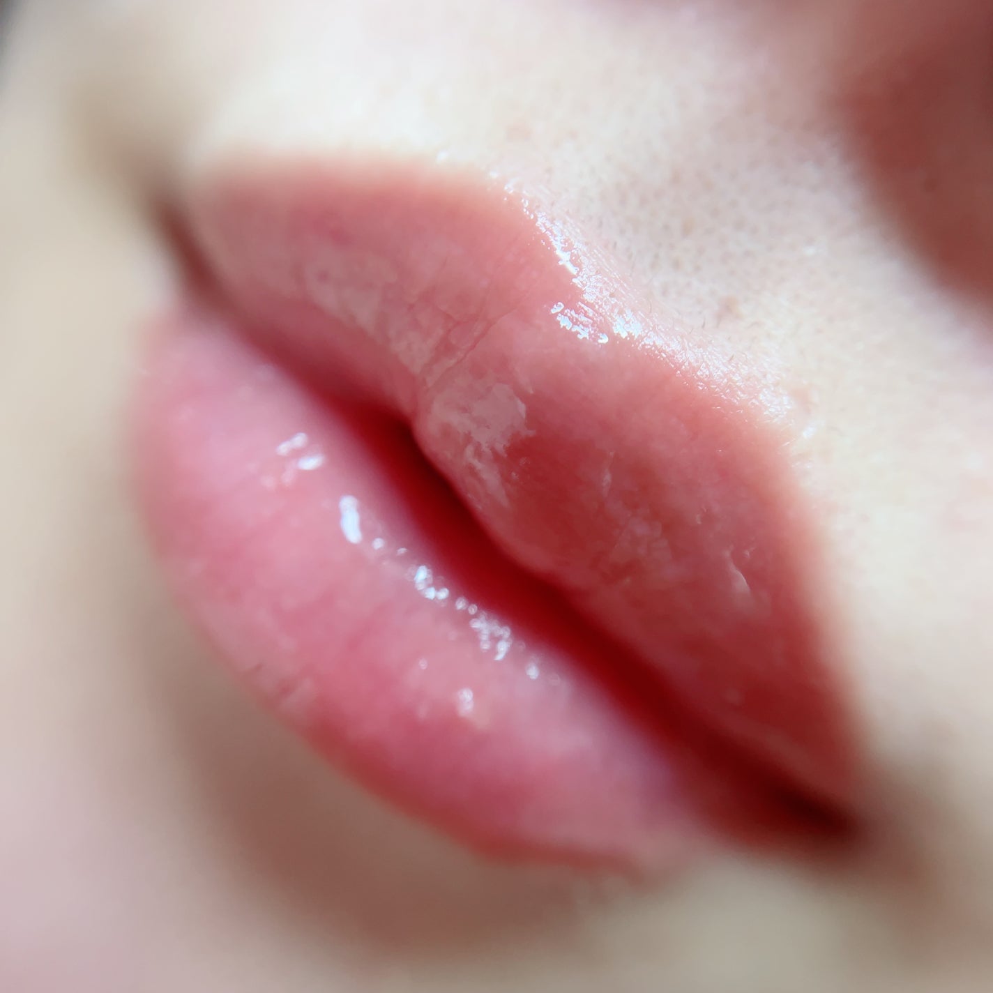 ã«ã³ã ðž on LIPS ãã
ۋ
ۋ
€ã·ã£ããã€ããªããð/çŸå®¹å»ççºæ³ã®é泚å
¥ããŒãã«ãã©ã³..ãïŒ4æç®ïŒ