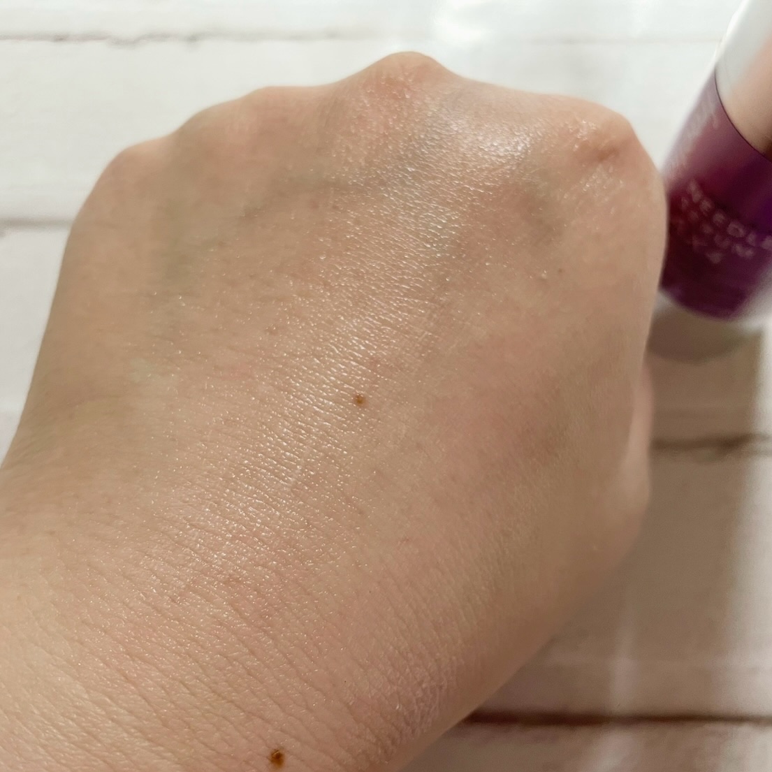 ニードルセラムＡＸ４/fractionalCC/美容液を使ったクチコミ（3枚目）