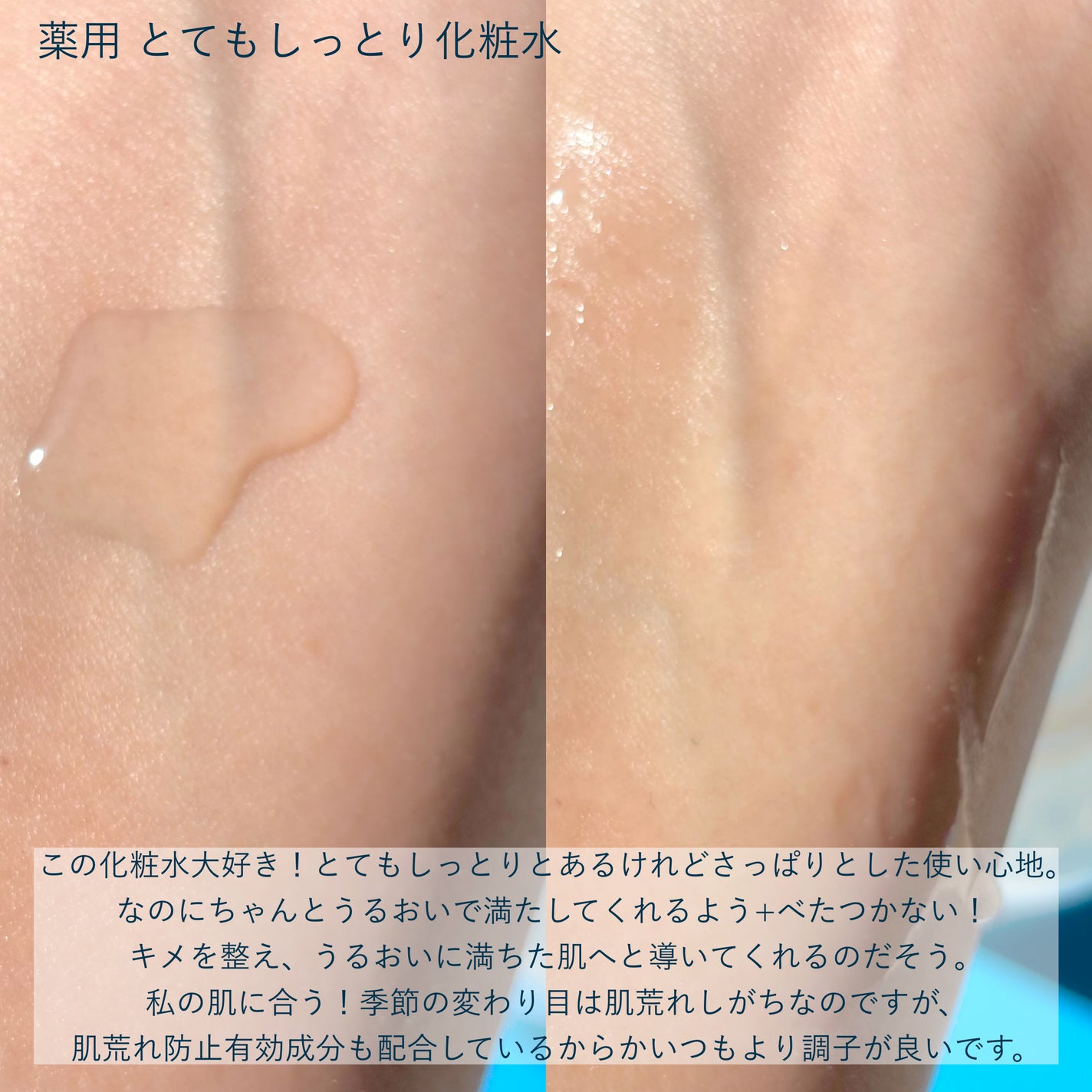 薬用ローション(とてもしっとり)/IHADA/化粧水を使ったクチコミ(3枚目)