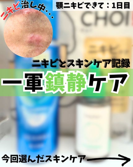 シカテロル美容液/beplain/美容液を使ったクチコミ(1枚目)