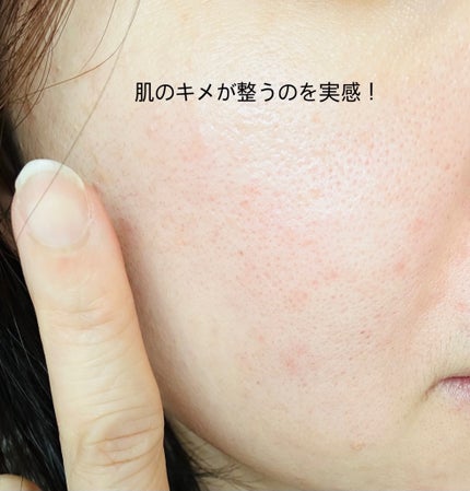 PDRNカフェインショット/IOPE/美容液を使ったクチコミ(4枚目)