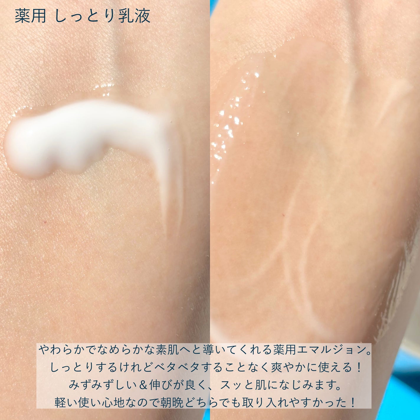 薬用ローション(とてもしっとり)/IHADA/化粧水を使ったクチコミ(4枚目)