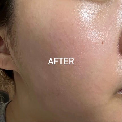 RXザ・セラミドスキンバリアモイスチャライザー/COSRX/フェイスクリームを使ったクチコミ(8枚目)