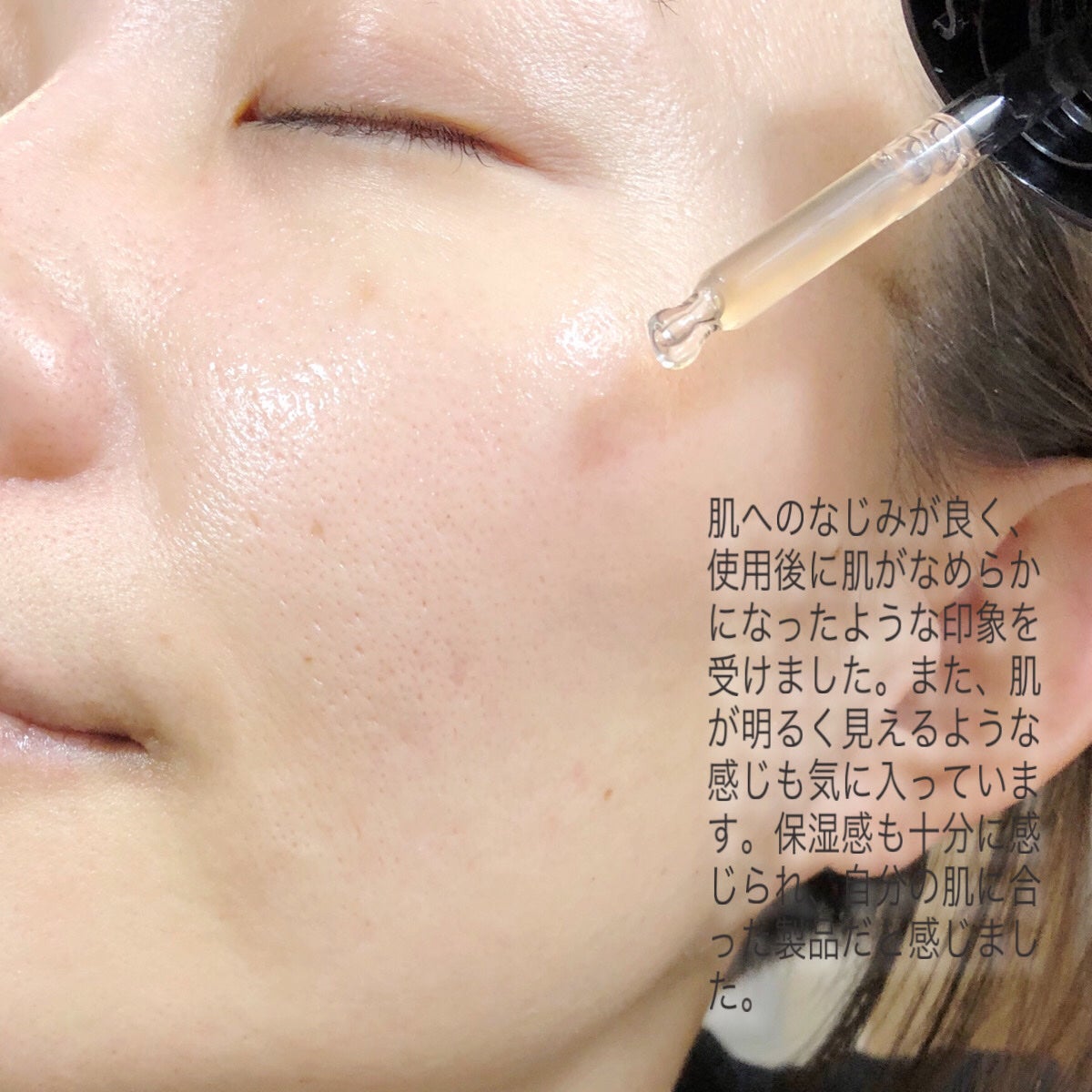 RXザ・アルファアルブチン2 ニキビ跡ケアセラム/COSRX/美容液を使ったクチコミ(5枚目)