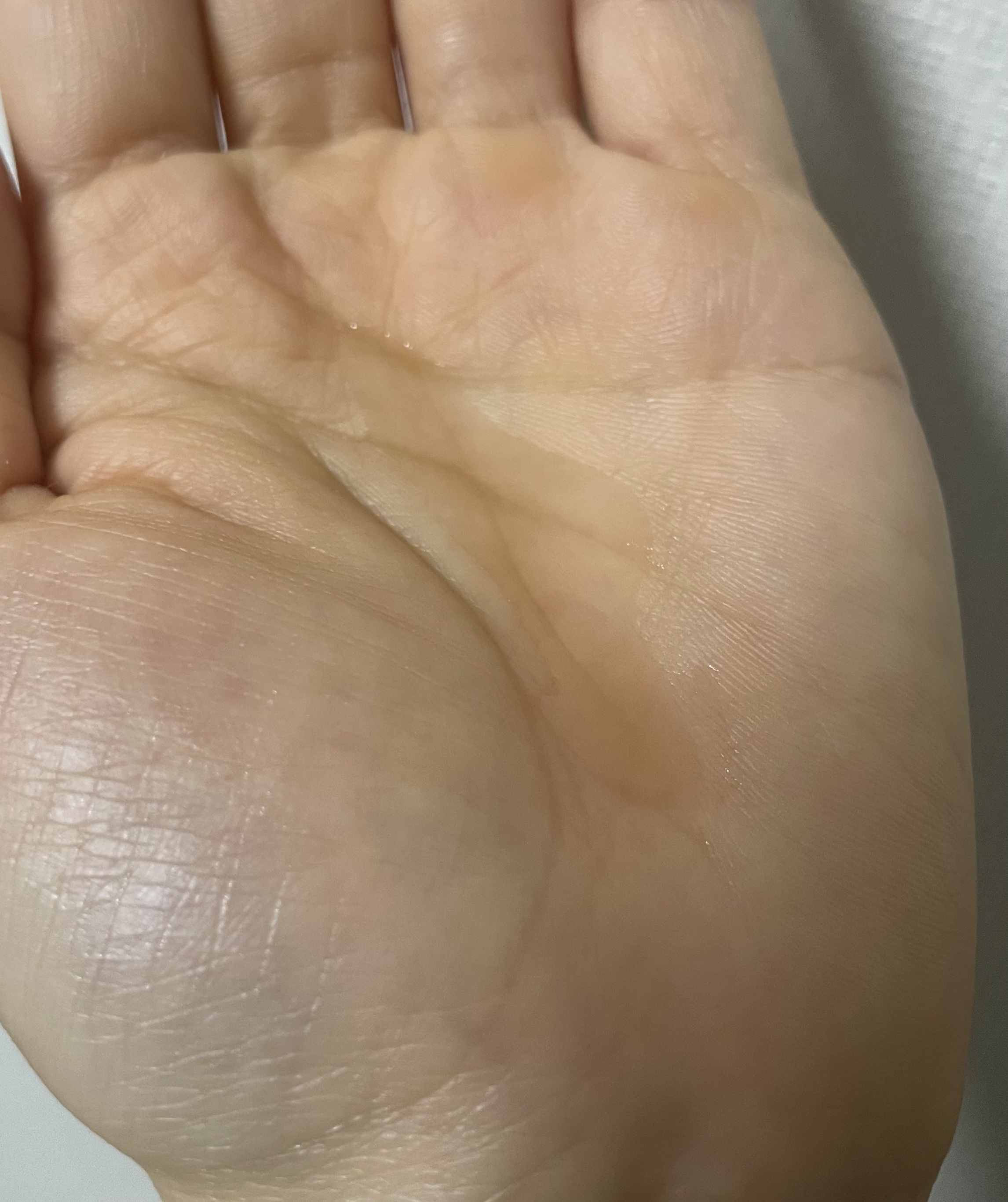 RXザ・アルファアルブチン2 ニキビ跡ケアセラム/COSRX/美容液を使ったクチコミ（3枚目）