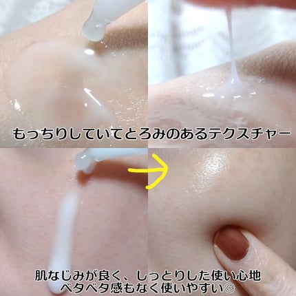 プロバイオシカ インテンシブ アンプル/SKIN1004/美容液を使ったクチコミ(3枚目)