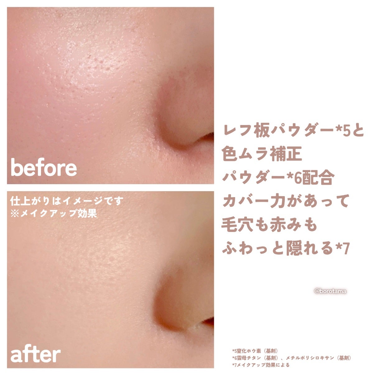 ãµã çŽ èèšå¿µæ¥ è¬çšã¹ãã³ã±ã¢ããŠã㌠ACãã¯ã€ããå»è¬éšå€åã/çŽ èèšå¿µæ¥/ãã¬ã¹ãããŠããŒã䜿ã£ãã¯ãã³ãïŒ8æç®ïŒ