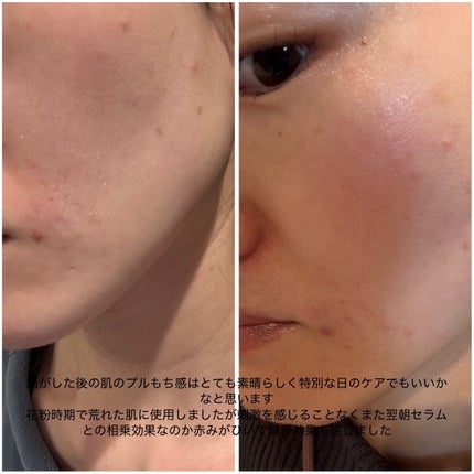 パーフェクト リアル パフォーマンス シカコラーゲンマスクパック /ダーマフィックス/シートマスク・パックを使ったクチコミ(5枚目)