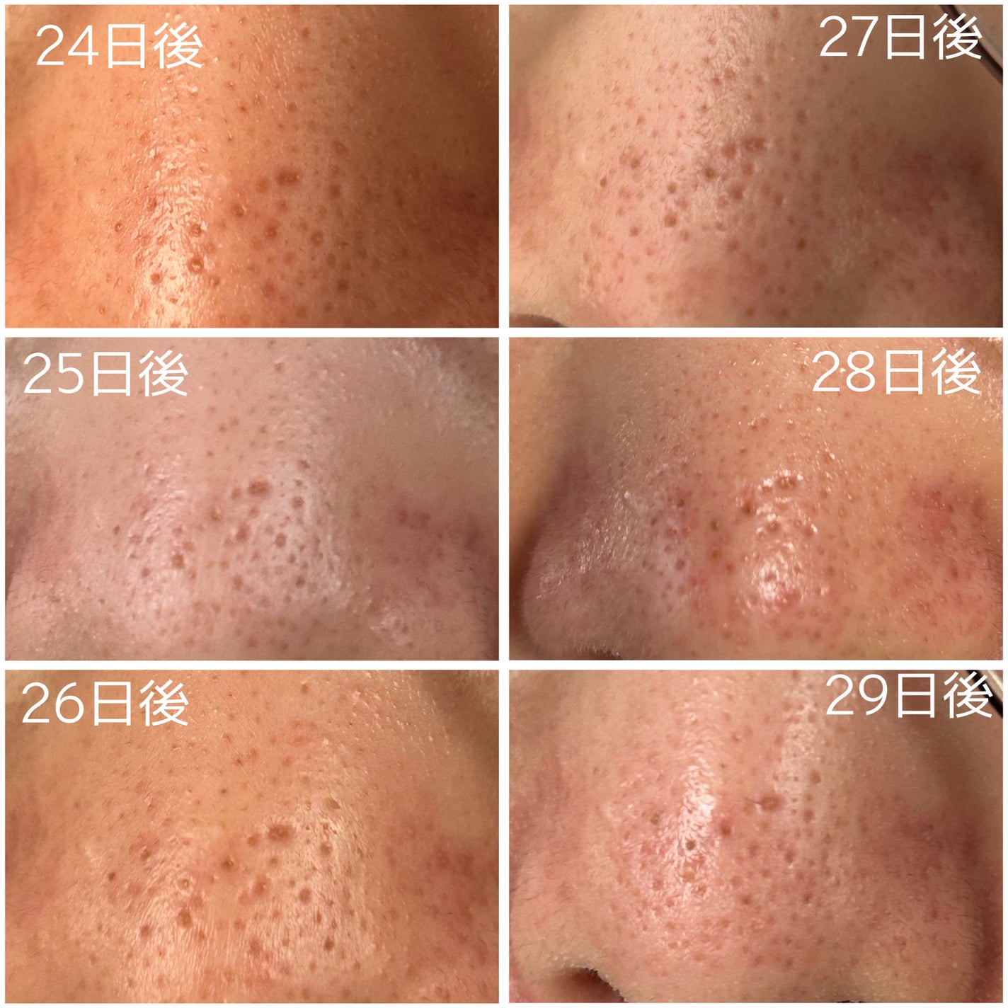 レチノール0.3 ナイアシンリニューイングセラム/Anua/美容液を使ったクチコミ(4枚目)