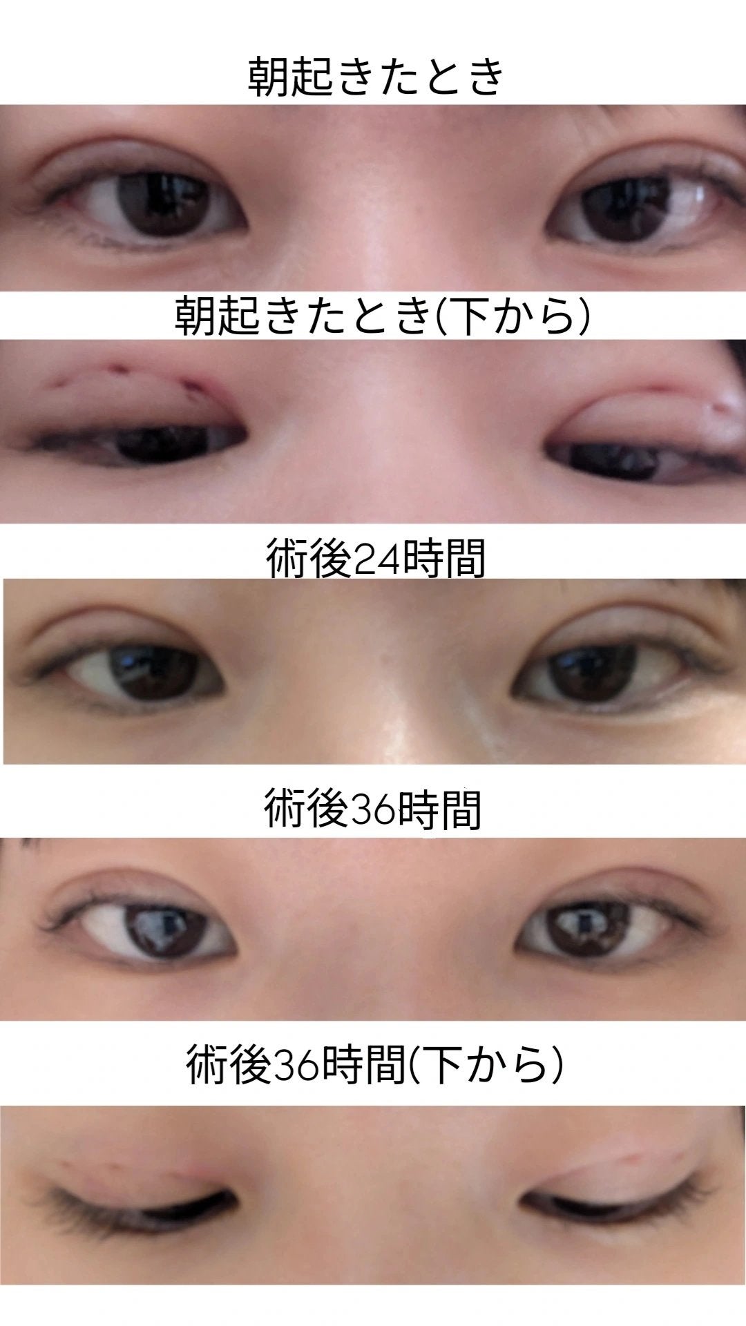 luzâªð¥â¬ on LIPS ãæ¹åçŸå®¹å€ç§ããã©ãŒãšããŒäºéè¡æ
åœ:äº¬éœæ²³åçºé¢ãåå±±å
çã¢..ãïŒ6æç®ïŒ