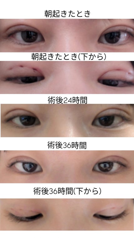 luzâªð¥â¬ on LIPS ãæ¹åçŸå®¹å€ç§ããã©ãŒãšããŒäºéè¡æ
åœ:äº¬éœæ²³åçºé¢ãåå±±å
çã¢..ãïŒ6æç®ïŒ