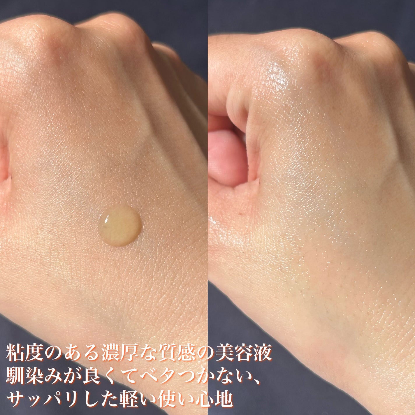 Dr.ROSA IV アンプル3種セット/Dr.ROSA/スキンケアキットを使ったクチコミ(7枚目)