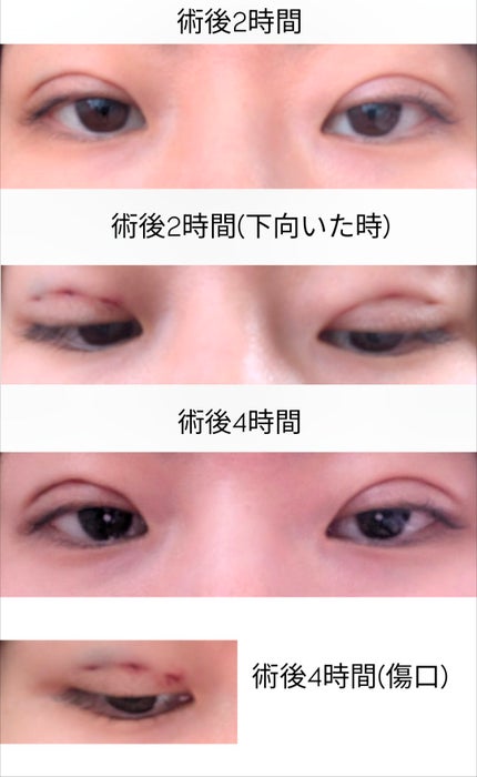 luzâªð¥â¬ on LIPS ãæ¹åçŸå®¹å€ç§ããã©ãŒãšããŒäºéè¡æ
åœ:äº¬éœæ²³åçºé¢ãåå±±å
çã¢..ãïŒ4æç®ïŒ