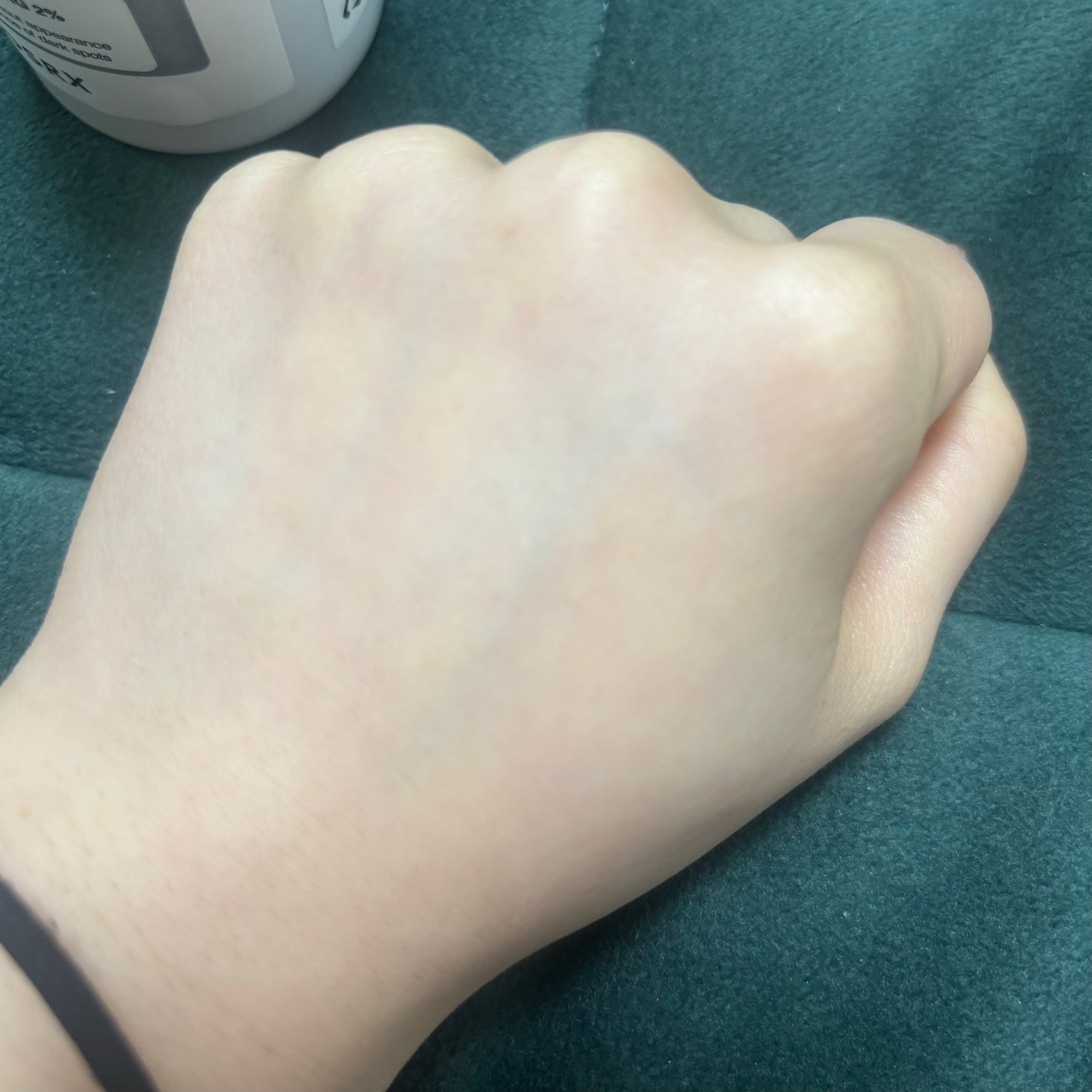 RXザ・アルファアルブチン2 ニキビ跡ケアセラム/COSRX/美容液を使ったクチコミ(3枚目)