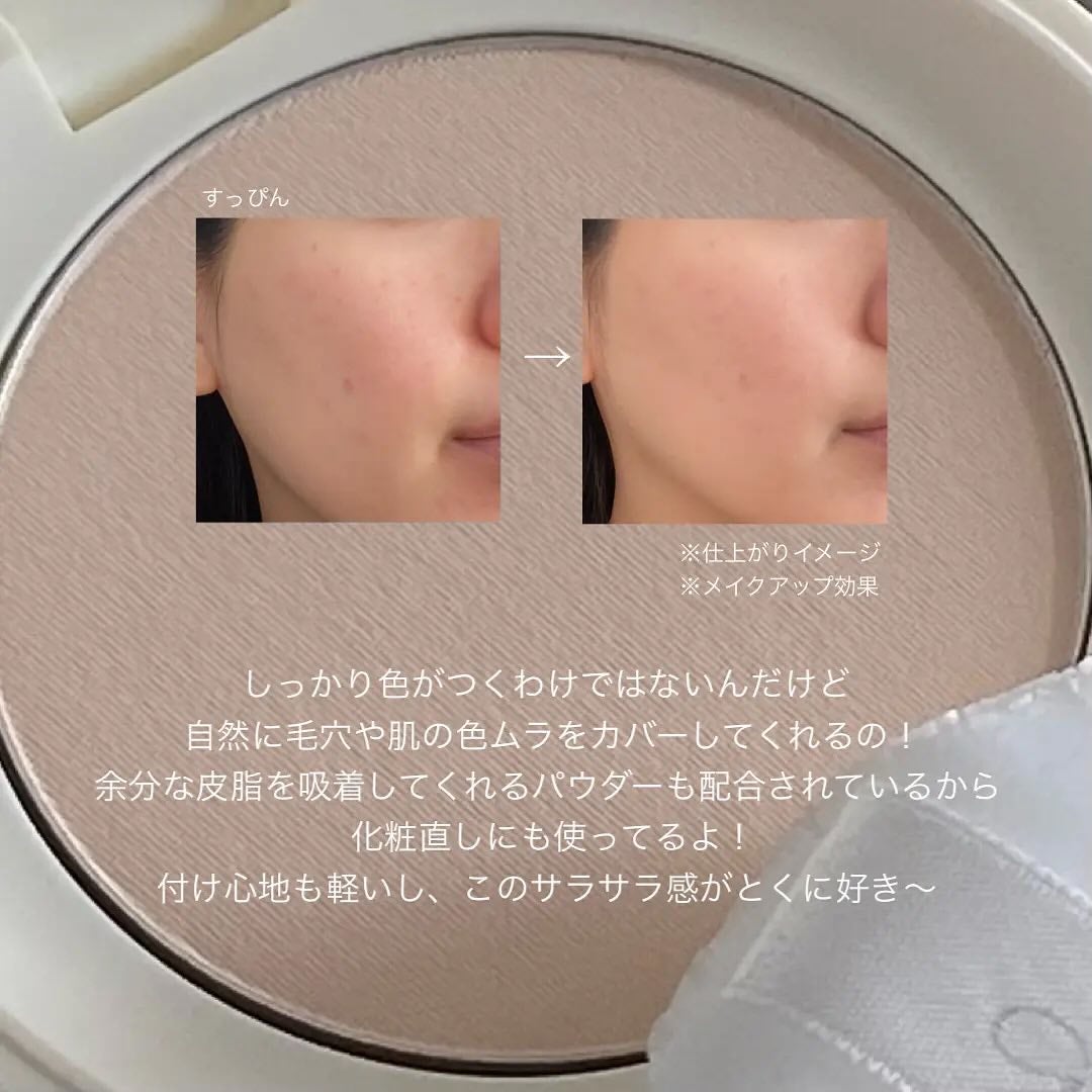 ãµã çŽ èèšå¿µæ¥ è¬çšã¹ãã³ã±ã¢ããŠã㌠ACãã¯ã€ããå»è¬éšå€åã/çŽ èèšå¿µæ¥/ãã¬ã¹ãããŠããŒã䜿ã£ãã¯ãã³ãïŒ7æç®ïŒ