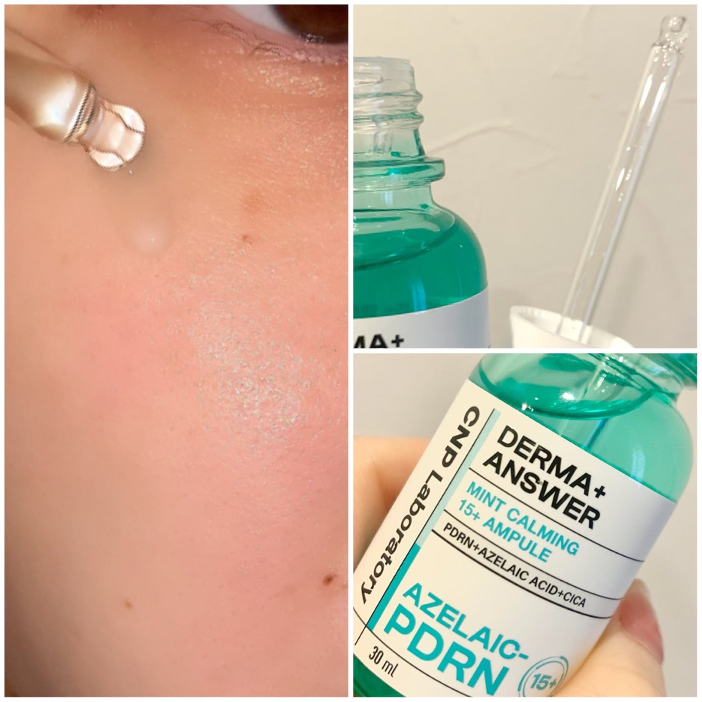 ダーマアンサーアゼライン酸ミントアンプル/CNP Laboratory/美容液を使ったクチコミ(3枚目)