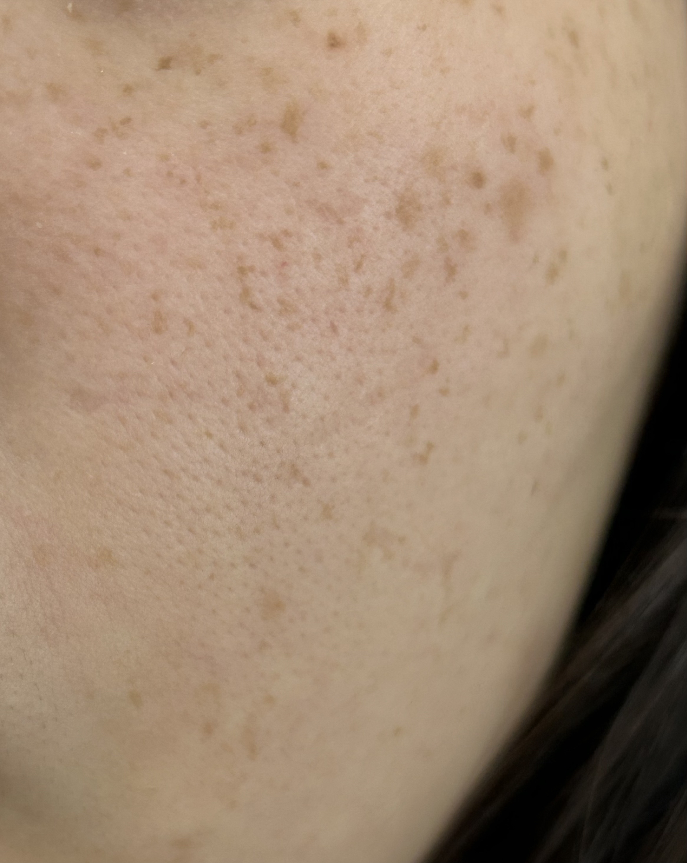 リセットクリアN/BENEFIQUE/化粧水を使ったクチコミ（3枚目）