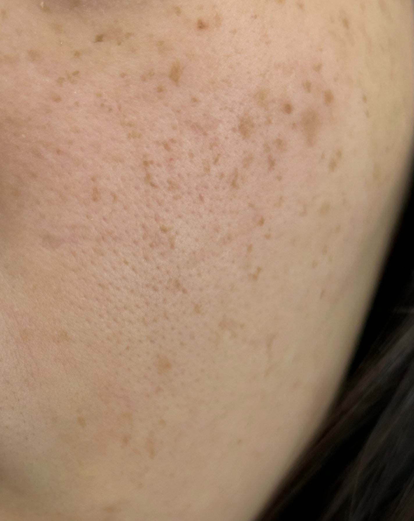 モイストケア ローション MB/d プログラム/化粧水を使ったクチコミ(3枚目)