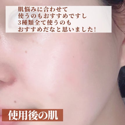 Dr.ROSA IV アンプル3種セット/Dr.ROSA/スキンケアキットを使ったクチコミ(6枚目)