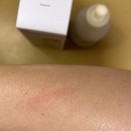 復活草ビフィダセラムファーミングドロップ/Abib /美容液を使ったクチコミ(4枚目)