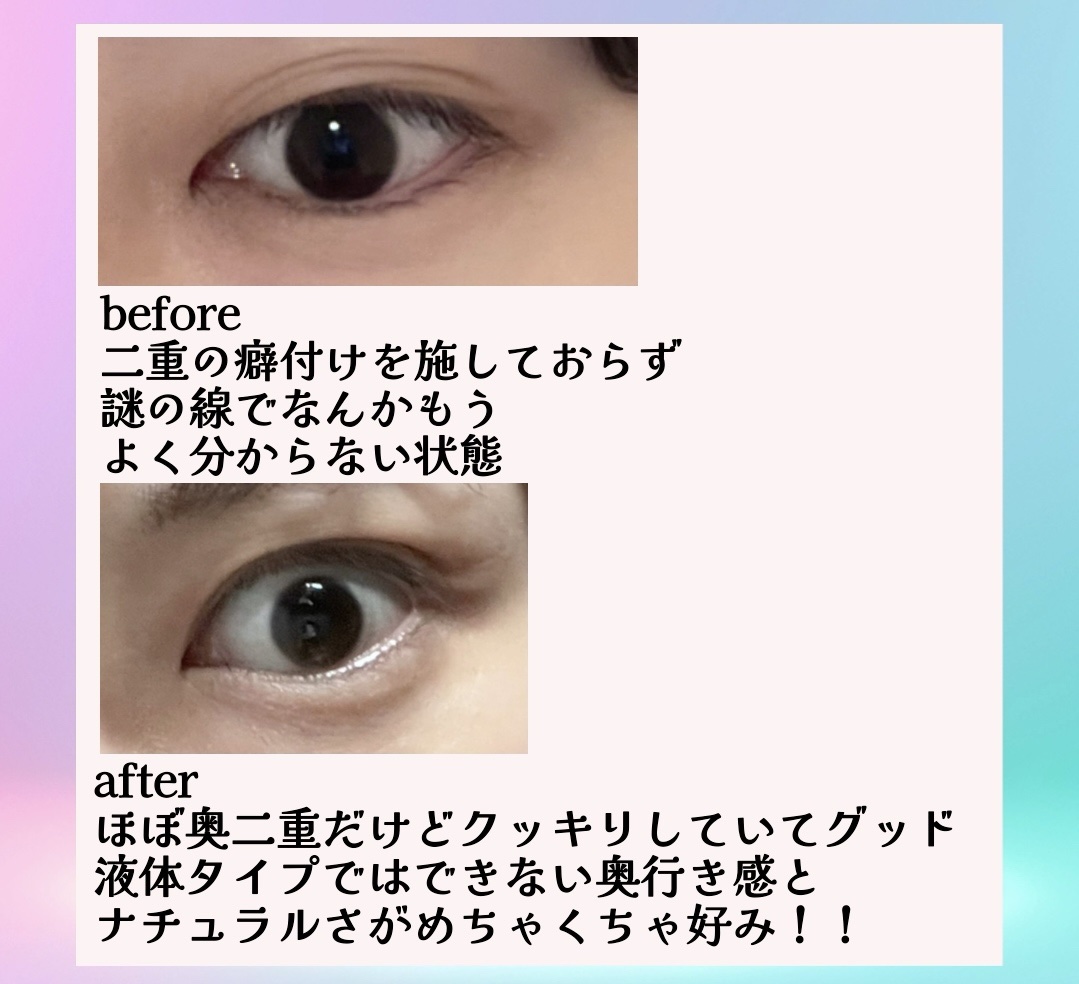 フィクス 二重キープ下地剤/メザイク/二重まぶた用アイテムを使ったクチコミ（3枚目）