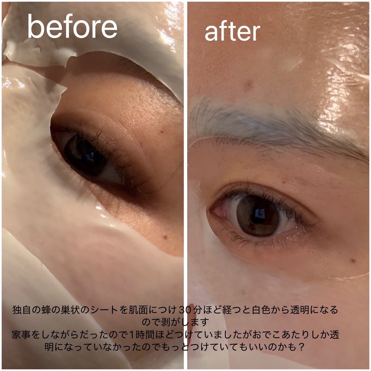 パーフェクト リアル パフォーマンス シカコラーゲンマスクパック /ダーマフィックス/シートマスク・パックを使ったクチコミ(4枚目)