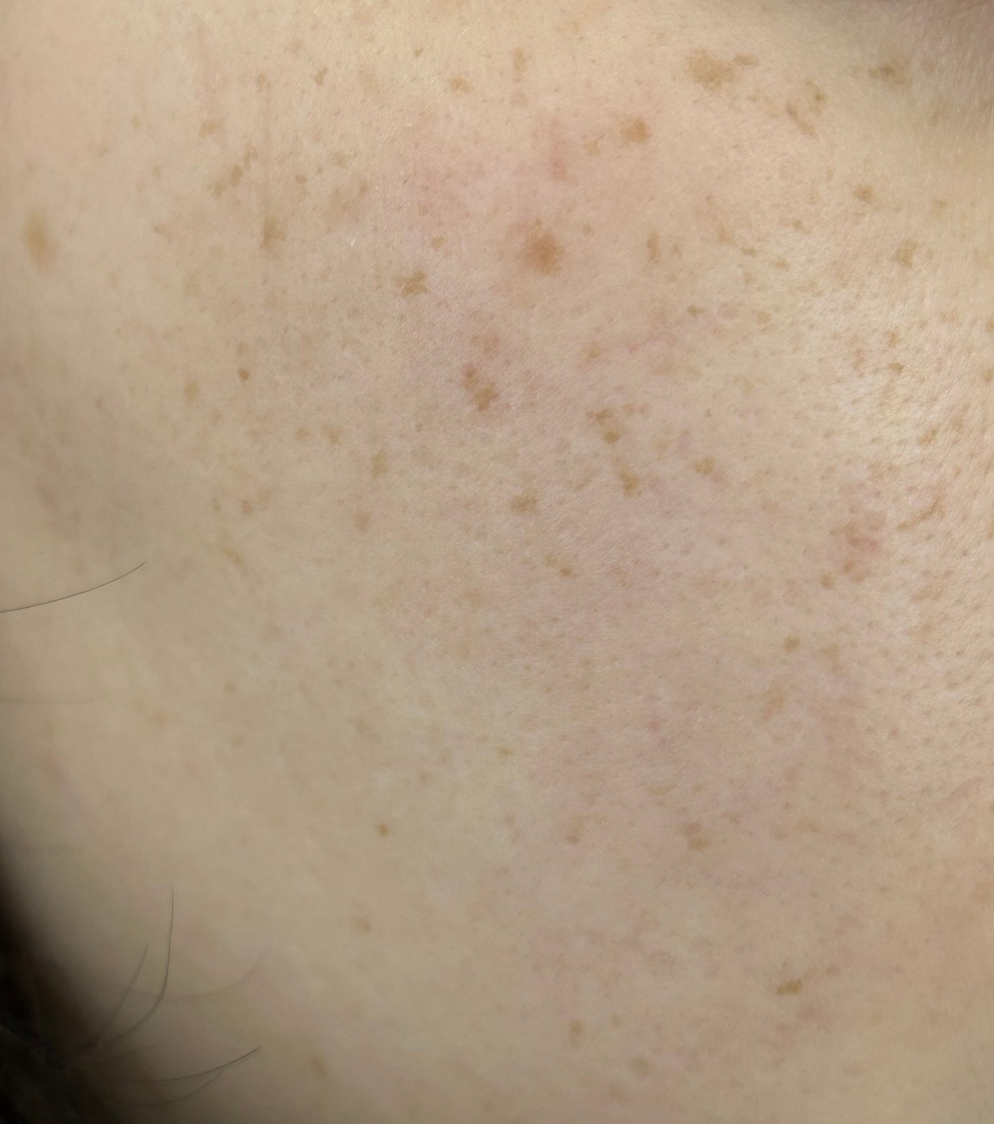 モイストケア ローション MB/d プログラム/化粧水を使ったクチコミ(4枚目)