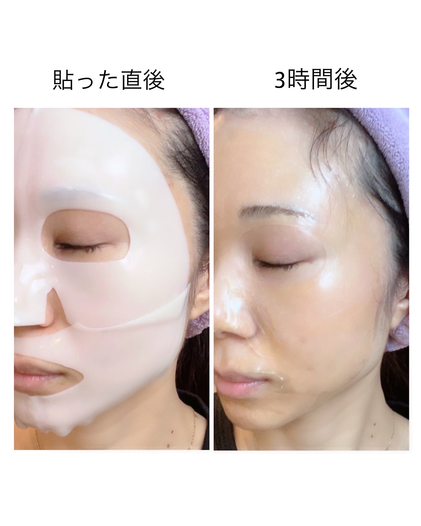 ビタナイアシンアミド リアルディープマスク/Biodance/シートマスク・パックを使ったクチコミ（3枚目）