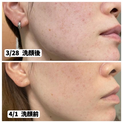 ナインセラム/Dr.Twenty Project/美容液を使ったクチコミ(5枚目)