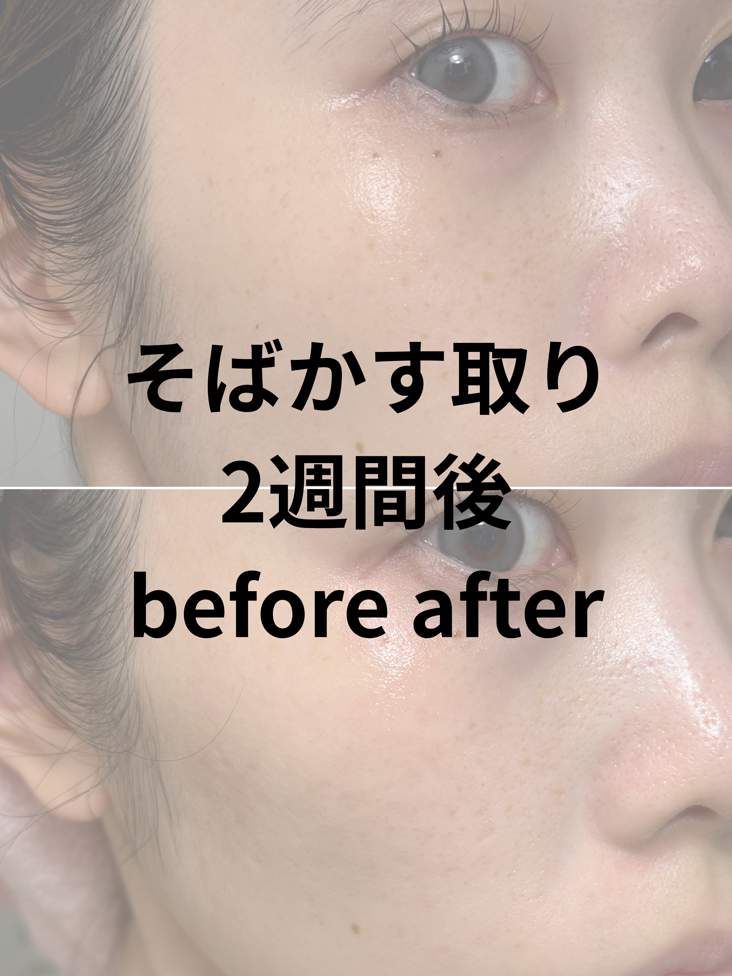 TXトーニングクリーム/VT/フェイスクリームを使ったクチコミ（1枚目）