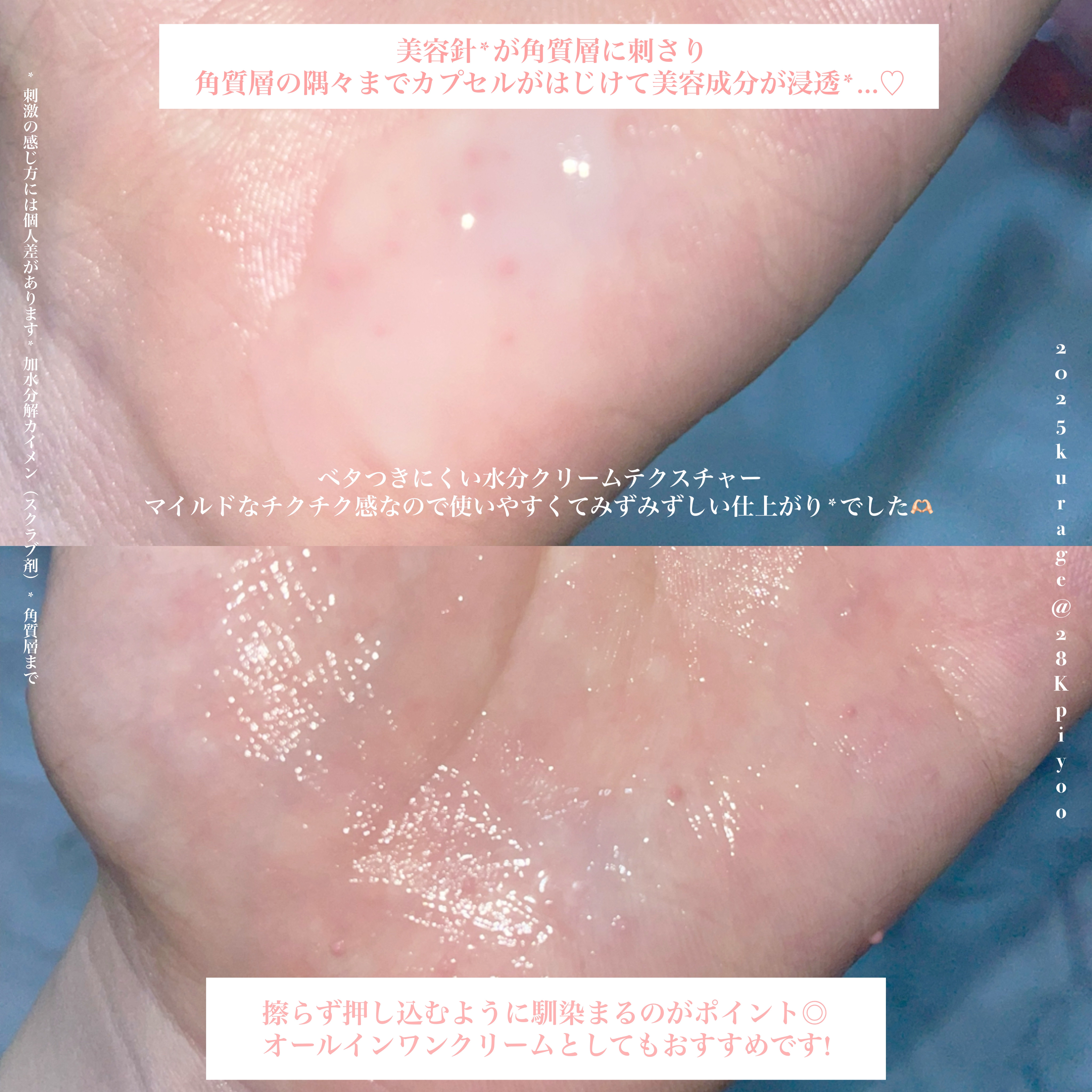 PDRNショット 1000＋/fractionalCC/美容液を使ったクチコミ（3枚目）